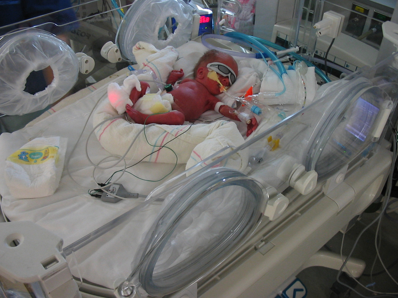 The conventional approach to treating preemies. (Image: The Hudson Family/Flickr)
